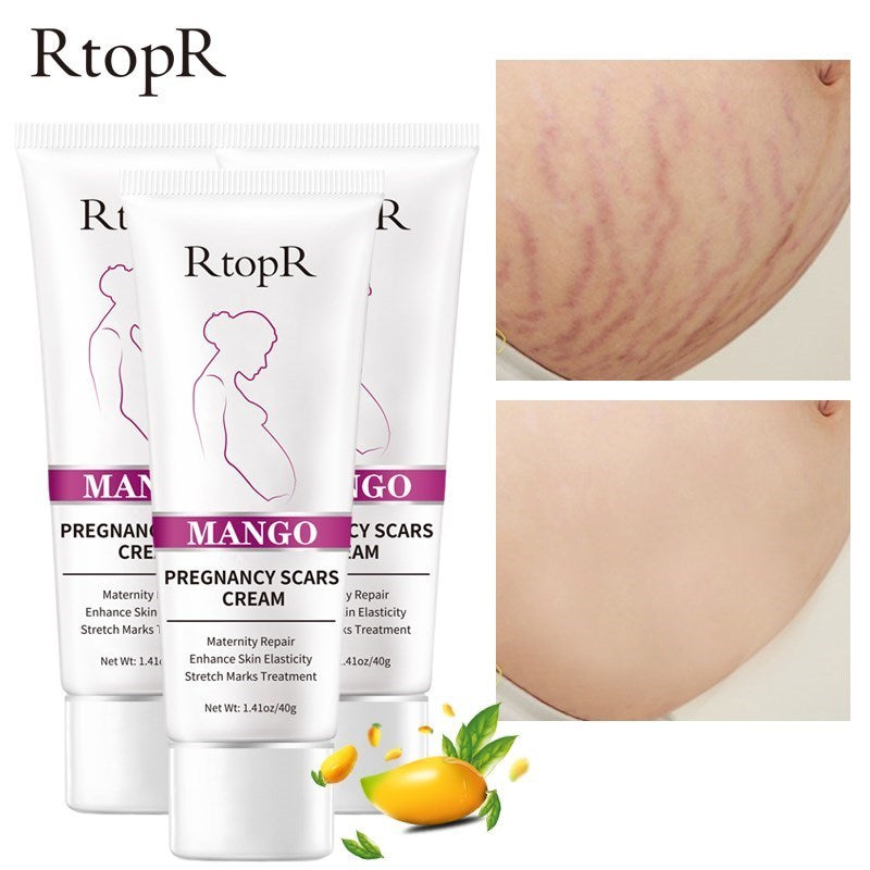 3Pcs Remove Pregnancy Scars Skin Body Cream Postpartum Stretch Marks Repair Cream Anti-Aging Skin Winkles Firming Body Cream