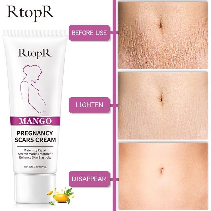 3Pcs Remove Pregnancy Scars Skin Body Cream Postpartum Stretch Marks Repair Cream Anti-Aging Skin Winkles Firming Body Cream