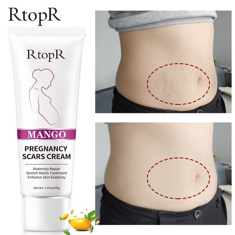 3Pcs Remove Pregnancy Scars Skin Body Cream Postpartum Stretch Marks Repair Cream Anti-Aging Skin Winkles Firming Body Cream